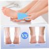 AUTSUPPL 4pcs Foot File Callus Remover for Heel Callus Toe Foot Scrubber Pedicure Tool view 2