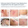 100% Silicone Scar Gel 3-Pack  3 x 1.06oz Scar Cream for Long-Term Scar Care  C-Section, Surgery, Acne, Keloids, Burns  Fades Old & New Scars Fast view 2