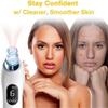 Portable Blackhead Remover Pore Vacuum, USB Rechargeable,6 Blackhead Extractor Tool,Electric Blackhead Vacuum Cleaner Blackhead ExtractorTool Removal Suction Beauty Device White view 4