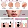 Blackhead Machine Vacuum Pore Cleaner, with Camera Visible Blackhead Removal Facial Pore Cleaner, with 4 Suction Heads view 3