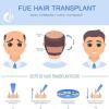 Hair Follicle Extractor, Seamless Hair Transplant Machine, Instrument Hair Hairline Extractor with Pedals, Speed Mode 3 Gears Adjustment & Safe Without Scars, for Prevent Hair Loss In Men and Women view 4