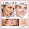 377 Anti Wrinkle Cream for Face, 377 Dark Spot Remover, Moisturizing & Rejuvenating Skin, 40g view 2