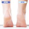 4 Pack Foot Pumice for Feet Pedicure Plastic Foot Scrubber Exfoliator for Dead Skin Cracked Heel Repair Callus Remover view 3