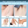 Painless Hair Removal Cream, Private Pubic Hair Remover for Women and Men Depilatory Creams for Body Legs Arms Underarms, Painless Bikini Hair Remover Cream Sensitive Skin Friendly 4.23 Fl Oz view 2