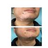 ZHEHZI Vitiligo cover up makeup, Waterproof white spot Concealer for Face, Hands, Legs and Body Coverage, Long-Lasting 3-7 Days, Full Coverage for All Skin Types 30ml (Light Skin, Hands and feet) view 4