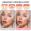 800 Pcs Pimple Patches Stars, Star Face Pimple Patches, Hydrocolloid Acne Patche, Hydrocolloid Containing Tea Tree Oil, Invisible Tear-Off Design, Beauty and Skin Care (5 Colors) view 4