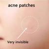 VibeSeal Pimple Patches for Face, 6 Size 102 Counts Acne Patches, Hydrocolloid Patches for Covering Zits and Blemishes Korean Skin Care, Vegan & Cruelty-Free, view 4
