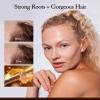 Biotin Shampoo for Hair Growth - Thickening & Volumizing Anti-Hair Loss Shampoo, Sulfate & Paraben Free - For Men & Women, All Hair Types, 300ML view 2