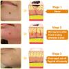 Bee Venom All-in-One Cream, Bee Venom Skin Treatment Cream, bee venom skin repair cream for Face and Body, Professional Moisturizing for All Skin Types (2) view 3