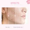8 Pcs SakuraSkincare Set Complete Facial Care with Vitamin C, Includes Cleanser, TonerSerum, Eye Cream, Essence Cream, Sakura hairpin, Sakura hair rope, Pink octopus face wash massager view 3