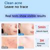 156pcs pimple patches for faceHolographic Cute Acne Patches -Hydrocolloid Star Pimple PatchesLaser light is colorful Used to cover acne and blemishes view 3