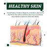 Hair Moss Anti-itching Shampoo Scalp Cleansing Anti-dandruff Hair Oil Control Anti-itching Refreshing Repair 100ml view 3