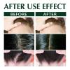 Hair Moss Anti-itching Shampoo Scalp Cleansing Anti-dandruff Hair Oil Control Anti-itching Refreshing Repair 100ml view 4