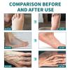 30g Hand And Foot Numbness Repair Korean Skin Body Beauty Cream Pain Cream view 4