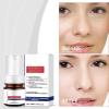 And Freckle Removing Serum Cream Spots Vitamin C Flaw Serum 40ml view 4