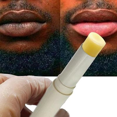 2PCS Lip Lightening for Dark Lips Lip for Smokers Dark Lip Treatment Lightening Cream for Pink Lips Lip Lightener for Smoker Lips Lip Lightening balm for Men and Women (Yellow)