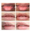 2PCS Lip Lightening for Dark Lips Lip for Smokers Dark Lip Treatment Lightening Cream for Pink Lips Lip Lightener for Smoker Lips Lip Lightening balm for Men and Women (Pink) view 4
