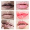 2PCS Lip Lightening for Dark Lips Lip for Smokers Dark Lip Treatment Lightening Cream for Pink Lips Lip Lightener for Smoker Lips Lip Lightening balm for Men and Women (Orange) view 4