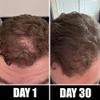 Pete & Pedro BOOST Hair & Beard Strengthening & Growth Natural Scalp Health Serum Oil For Men & Women - With Rosemary, Biotin & 20 plus Essential Oils | Shark Tank Featured, 2 oz. view 3