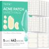 TKTK Bulk Acne Patches Day and Night 435 Count + Pimple Patches for Face 443 Count, 5 Sizes Pimple Stickers for Covering Zits, Blemishes and Breakouts view 3