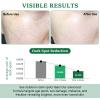 Dark Spot Remover for Face and Body - Dark Spot Corrector for Sun Spots Age Spots Freckles Melasma Brown Spot - Dark Spot Correcting Glow Serum with 360-Degree Roller 0.67 Fl Oz view 2