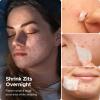 LitBear Pimple Patches for Face, 600 Counts Day and Night Acne Patches, Hydrocolloid Patches for Covering Zit and Blemishes, Large Breakouts, 5 Sizes Thin & Thick Spot Dots Stickers for Chin, Forehead view 4