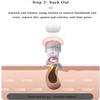 Blackhead Remover Pore Vacuum Cleaner- Upgraded Blackhead Acne Comedone Face Cleaning Tools Pimple Extractor Blackhead Removal Kit,Suction Power for Facial Skin view 2