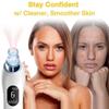 Blackhead Remover Vacuum, Blackhead Pore Vacuum, Electric Facial Blackhead & Blemish Removers Cleaner, Blackhead Vacuum for Women view 4