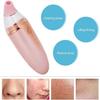 Blackhead Remover Pore Vacuum,Rechargeable Facial Cleansing Brush, Facial Cleaner for Exfoliating, Massaging and Deep Pore Cleansing view 4