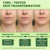 Neck Firming Cream with Retinol and Collagen Moisturizer, 1.7 Fl Oz view 4