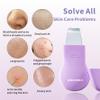 Blackhead Remover Tool,Silicone Face Scrubber, 2 in 1 Nose Pore Brush Scraper for Deep Cleansing,Face Skin Spatula, Nose Black Head Remover, Pore Cleaner Skin Care Tool for Men Women (Purple) view 3