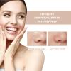 Ouhoe Purifying Exfoliating Gel, New Ouhoe Purifying Exfoliating Moisturizing Gel, Moisturizing, Gentle, Non-Greasy, Cleansing Peeling Cream, Cleans Dirt & Oils for the Whole Body (3pc, 1.76oz) view 3