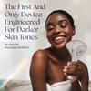 Epilaser Dark Skin At-Home Laser Hair Removal, Safe - Wont Cause Skin Bleaching, Hypopigmentation | Intelligent, Clinical Strength, Painless Permanent Hair Removal for Face, Body, Bikini Line view 2