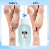 MOWLIE Professional Callus Remover for Feet  Extra Strength Foot Callus Remover Gel with 2 Glass Sandpaper Discs for Electric Foot Callus Remover,Foot Care kit - 50 ml/1.76 fl.oz view 2
