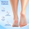 MOWLIE Professional Callus Remover for Feet  Extra Strength Foot Callus Remover Gel with 2 Glass Sandpaper Discs for Electric Foot Callus Remover,Foot Care kit - 50 ml/1.76 fl.oz view 4