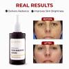 Abera Skin Renewing Serum, Melasma Treatment For Face, High-Performance Anti-Wrinkle, High Potency Saffron Extract, Lavandula Stoechas Extract, Hydrating Serum, 1.01 Fl Oz view 3