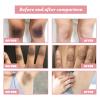 BEROZA Crema Reparadora Para Manchas Oscuras 50ml, Cremas Para Las Manchas de La Cara, Crema ntima para mujeres, Adecuado para varias reas como cara, axilas, cuello, zona privada view 4