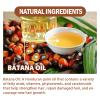 AMALIA Batana Oil for Hair Growth, Enhances Hair Thickness, Prevents Loss for Men & Women, 4.05 fl oz view 2