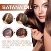 AMALIA Batana Oil for Hair Growth, Enhances Hair Thickness, Prevents Loss for Men & Women, 4.05 fl oz view 3
