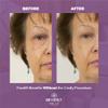 Beverly Hills V-lift Instant Eye Lift & Instant Facelift Anti Aging Eye Serum Treatment Bundle with Discount - Serum Treatment for Dark Circles, Wrinkles & Under Eyebags for Women & Men view 4