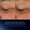 Este Lauder Advanced Night Repair Eye Lift + Sculpt | Eye Cream with 2HA Volume Filler & Hexapeptide-8, 0.5 Fl Oz view 4