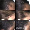 Ccred Restoring Hair & Edge Drops - Daily Peptide Serum for Fuller-Looking Hair, Supports Hairline & Scalp Health, Strengthens Roots,1.7 fl oz view 3