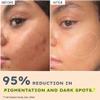 44% Rice Water Brightening Face Serum Pads | 5% Niacinamide & Alpha Arbutin to Reduces Dark Spots & Pigmentation | Toner Pads with Serum for Glowing Glass Skin | All Skin Types - 50N view 4