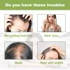 AMALIA Rosemary Mint Scalp & Hair Strengthening Oil, 2.02 fl oz, with Biotin for Hair Growth, Daily Scalp Treatment view 3
