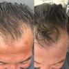 Dr. Dee Co. Reset Hair Care Duo, Scalp Therapy Spray with Silver + Peptides and Bounce Back Smoothing Cream for Curly Hair, 2 fl oz + 8 fl oz view 2