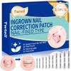 5 Sizes, 10 Pcs - Ingrown Toenail Treatment Kit, Titanium Alloy Ingrown Toenail Removal Kit, Nails Corrector Tool & Remover Strips - Ingrown Toe Nail Quick Relief(0.51/0.59/0.67/0.7/0.74 inches) view 1