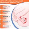 5 Sizes, 10 Pcs - Ingrown Toenail Treatment Kit, Titanium Alloy Ingrown Toenail Removal Kit, Nails Corrector Tool & Remover Strips - Ingrown Toe Nail Quick Relief(0.51/0.59/0.67/0.7/0.74 inches) view 4