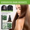 OUHOE Rosemary Oil for Hair and Scalp, Natural Rosemary Mint Scalp & Hair Strengthening Oil for Dry, Itchy Scalp, Thickening & Hydration Products for Damaged Hairs & Split Ends (1pc) view 4