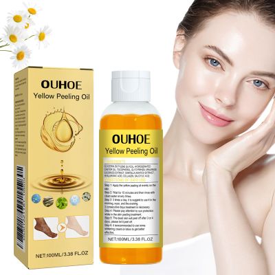 OUHOE Exfoliating Yellow Peeling Oil for Dark Skin, 1.7oz Strong OUHOE Peeling Oil Extra Strength for Exfoliating, Softening, Callus Removal, Dark Skin, Cutin, Callus Skin (1pc)