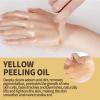 OUHOE Exfoliating Yellow Peeling Oil for Dark Skin, 1.7oz Strong OUHOE Peeling Oil Extra Strength for Exfoliating, Softening, Callus Removal, Dark Skin, Cutin, Callus Skin (1pc) view 2